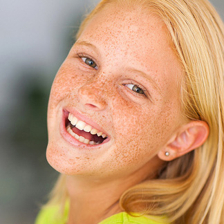 invisalign teen info